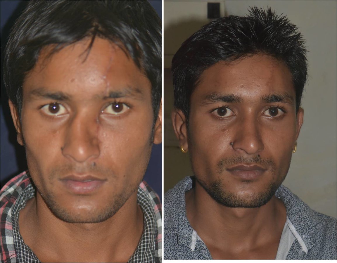 The Nose Clinic - The Nose Clinic