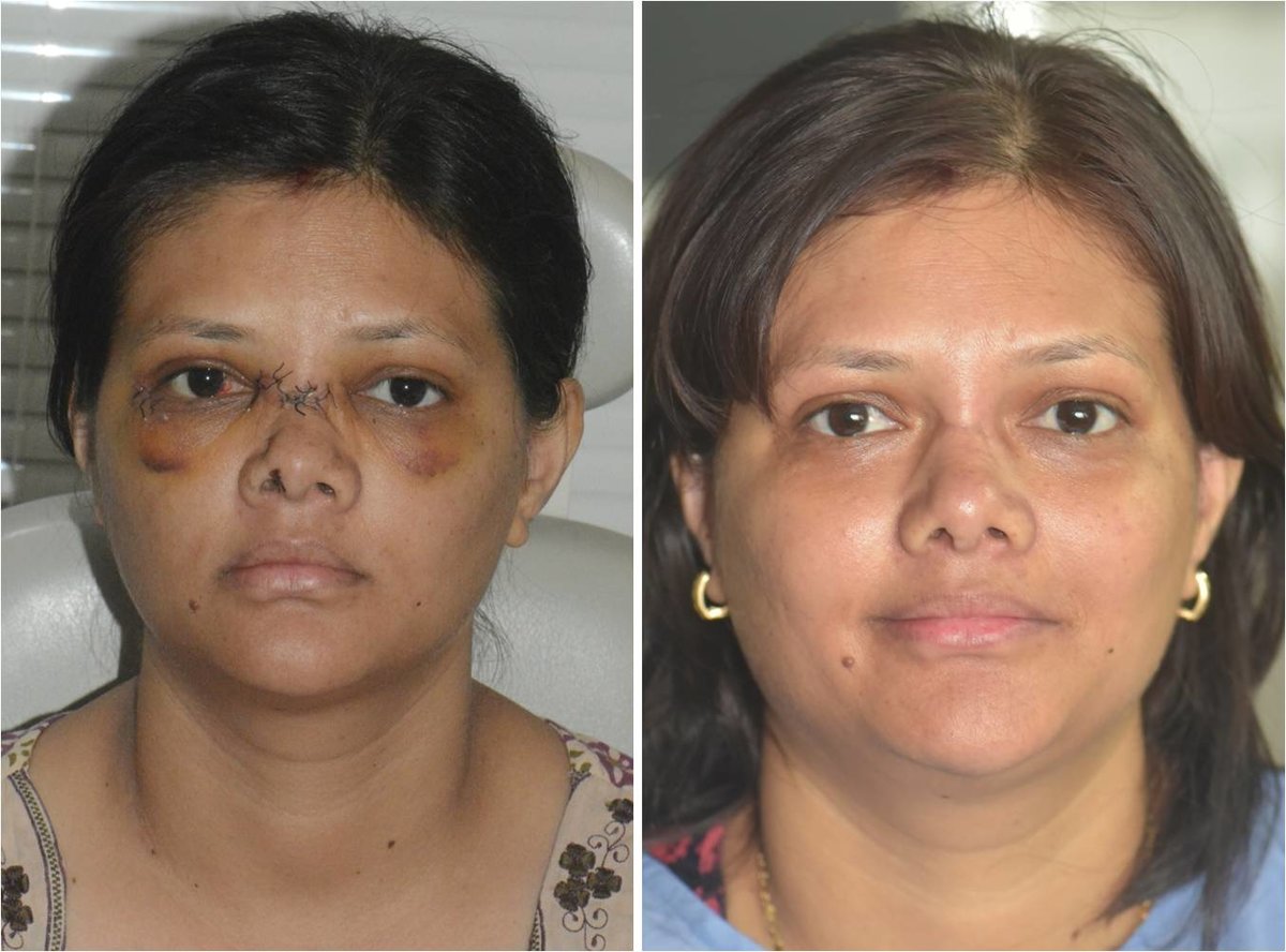 The Nose Clinic - The Nose Clinic