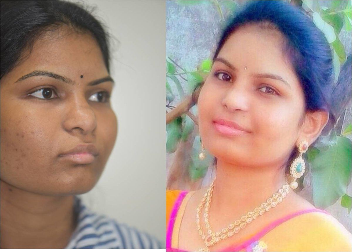 The Nose Clinic - The Nose Clinic