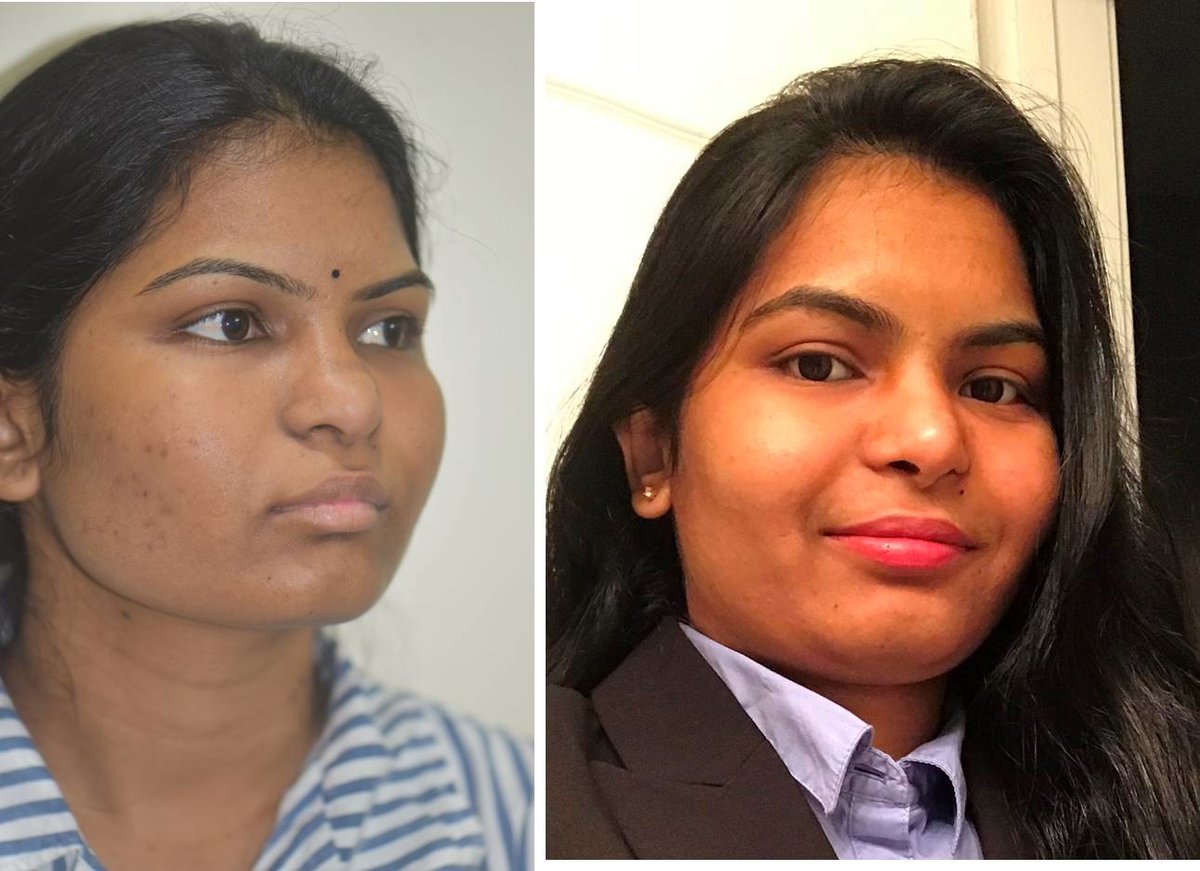 The Nose Clinic - The Nose Clinic