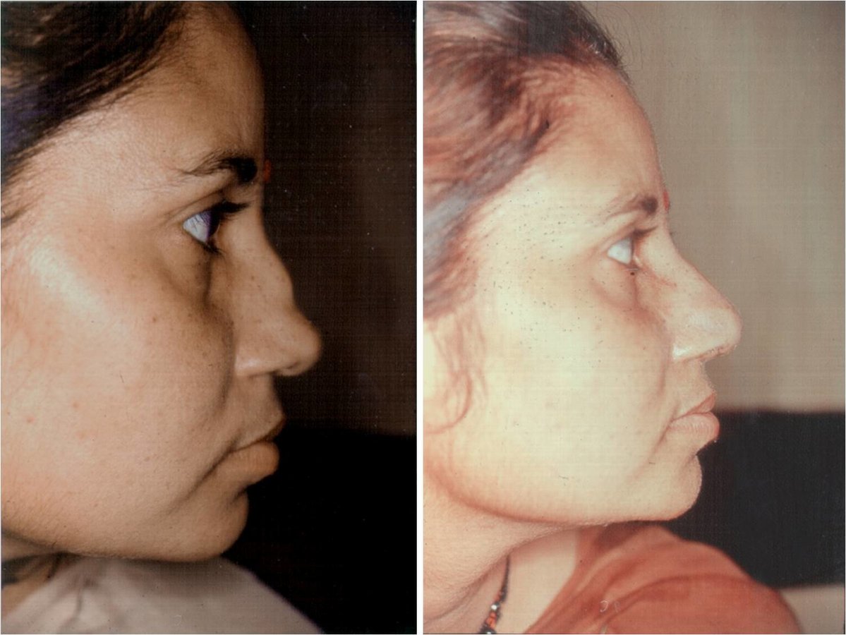 The Nose Clinic - The Nose Clinic