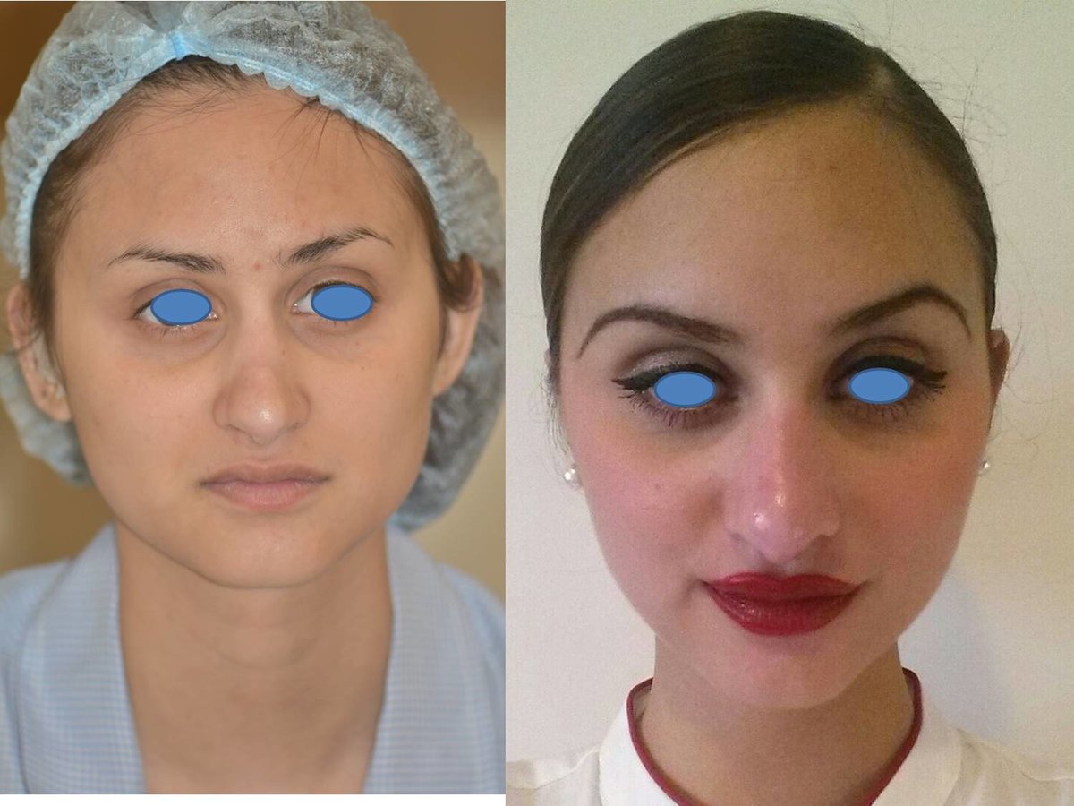 The Nose Clinic - The Nose Clinic