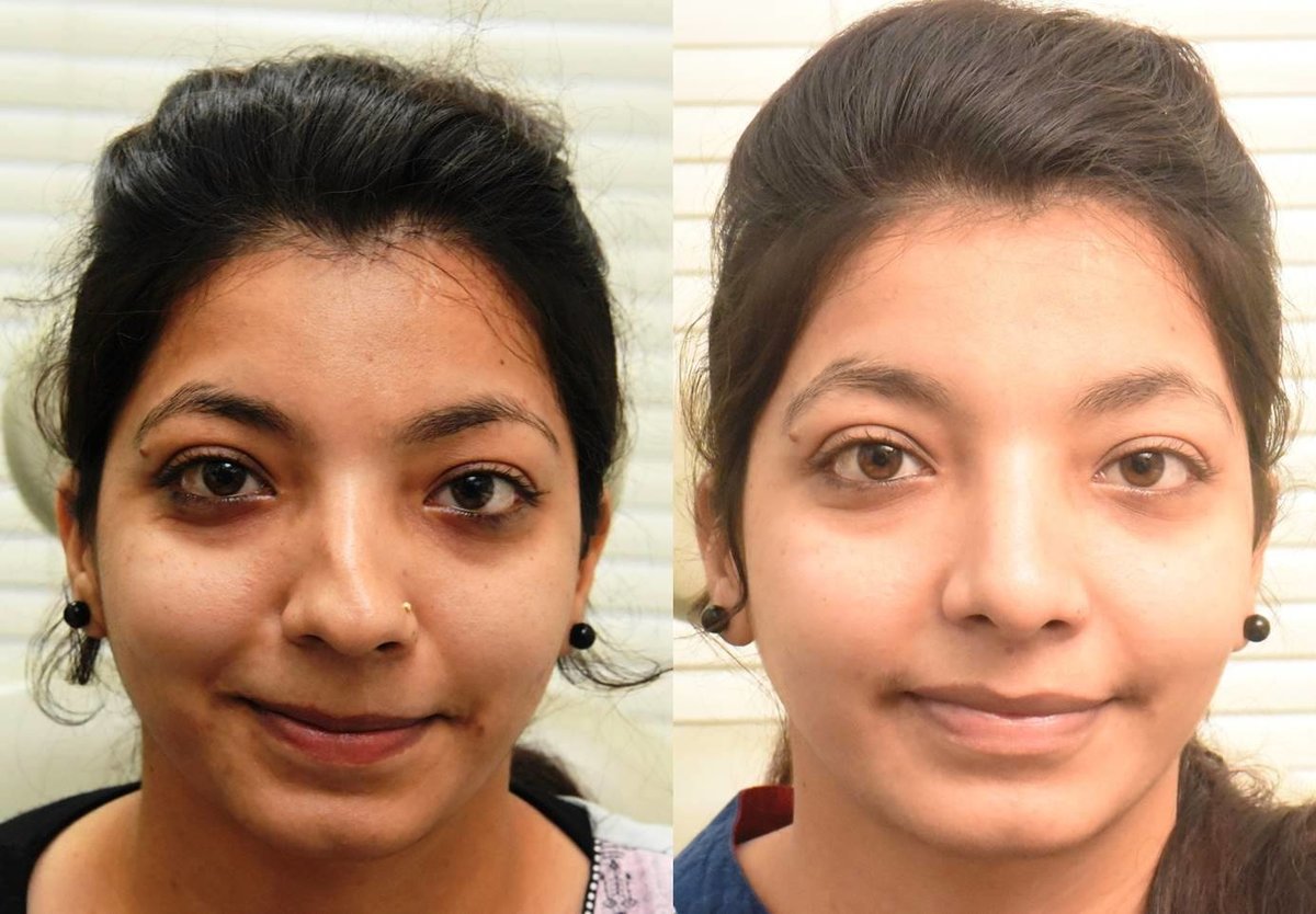 The Nose Clinic - The Nose Clinic