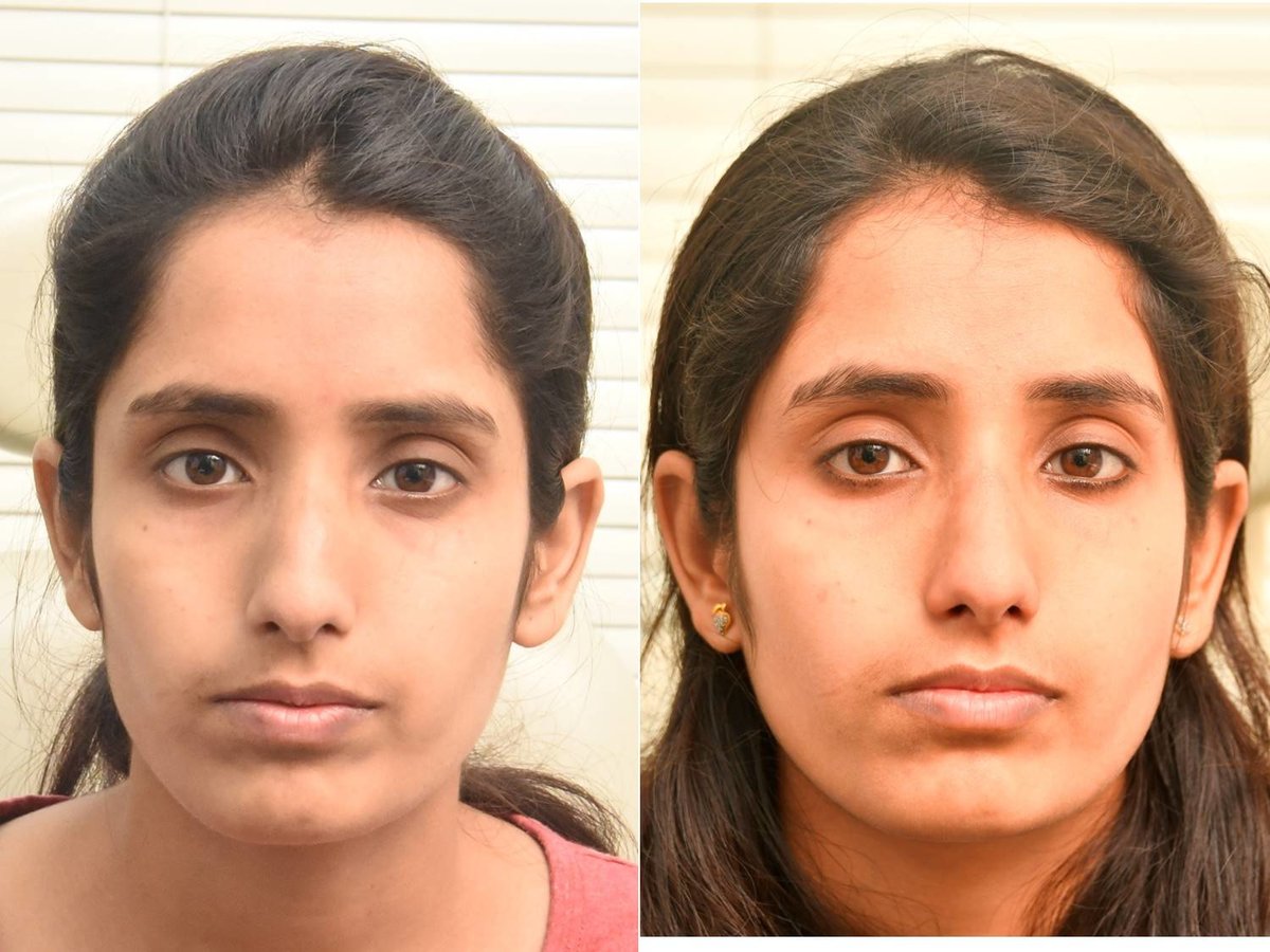 The Nose Clinic - The Nose Clinic