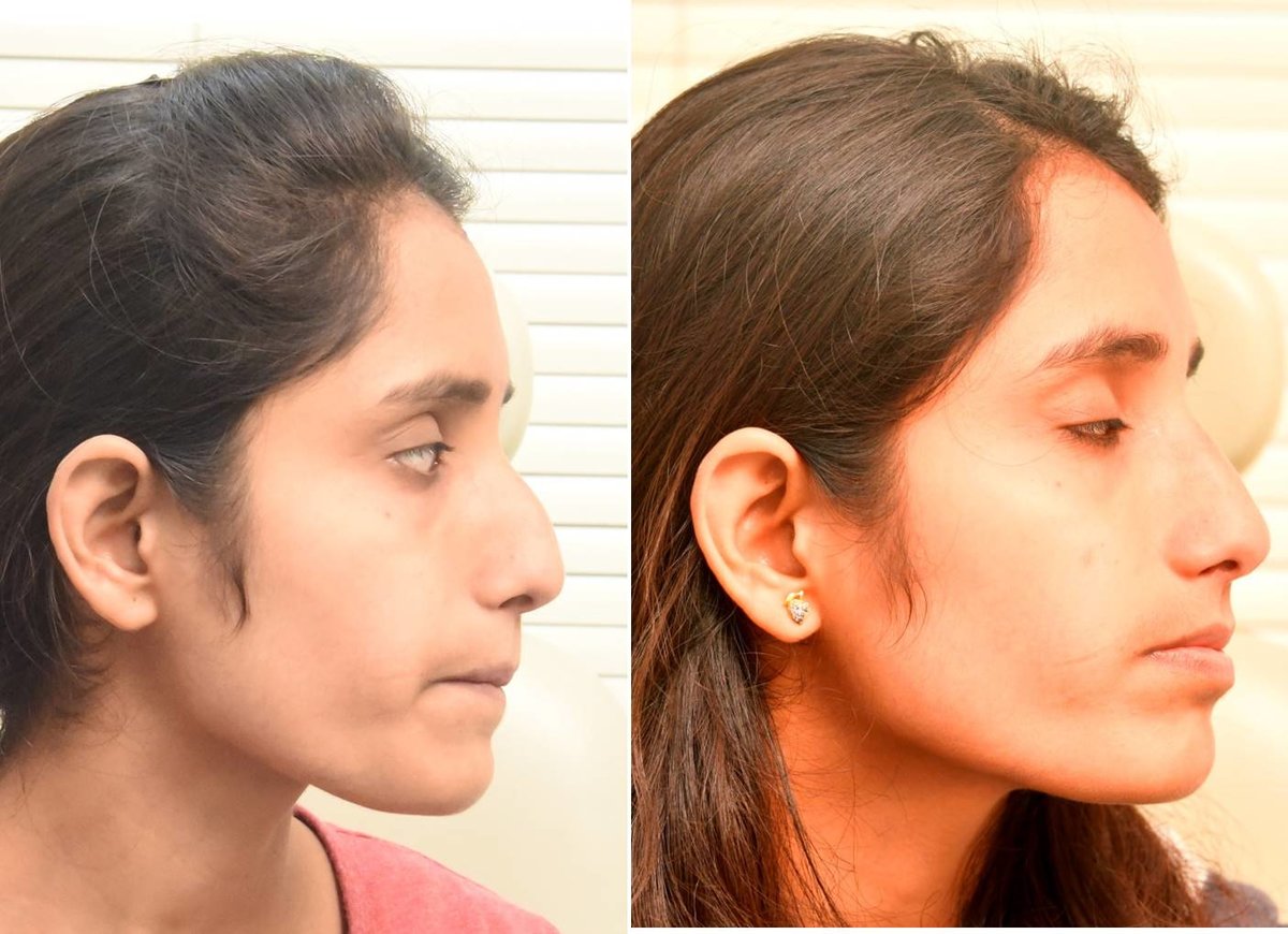 The Nose Clinic - The Nose Clinic