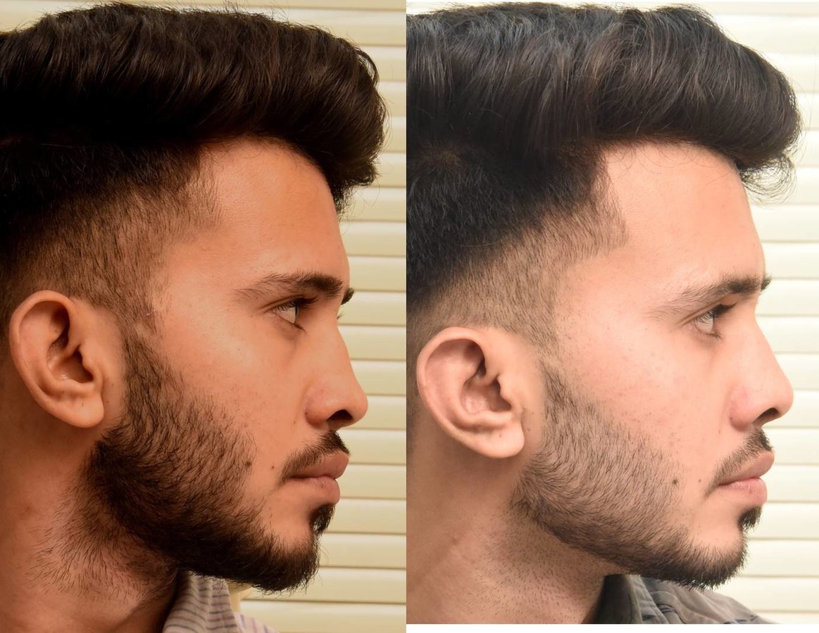 The Nose Clinic - The Nose Clinic