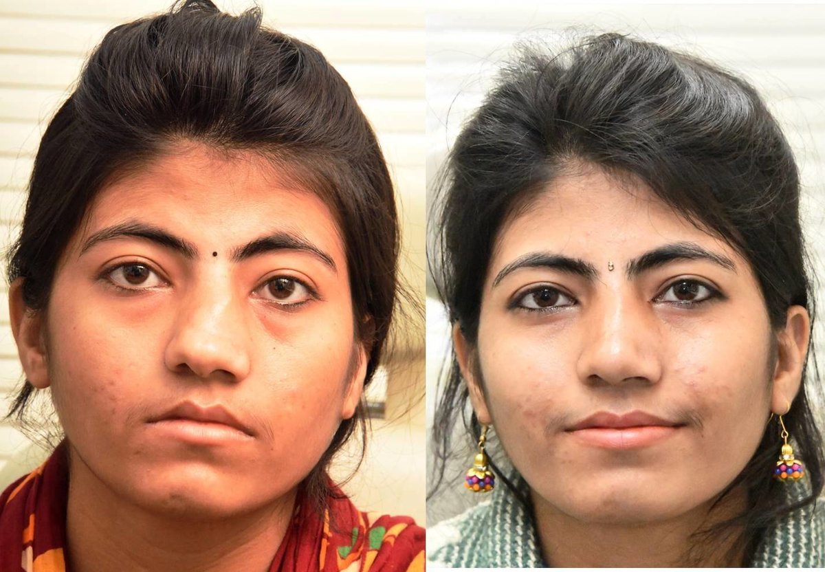 The Nose Clinic - The Nose Clinic