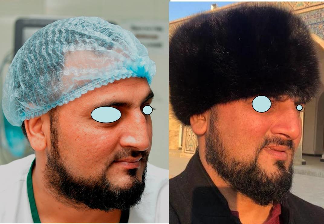 The Nose Clinic - The Nose Clinic