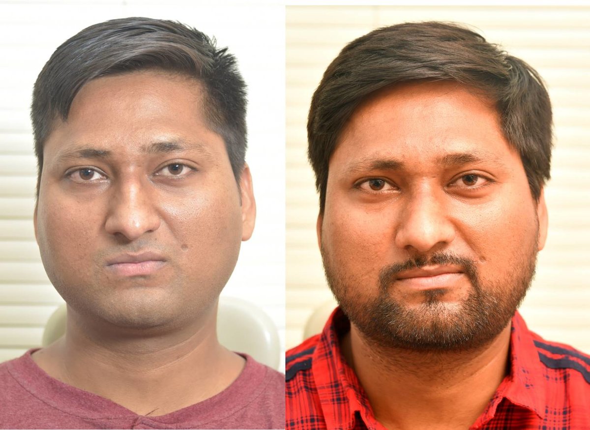 The Nose Clinic - The Nose Clinic