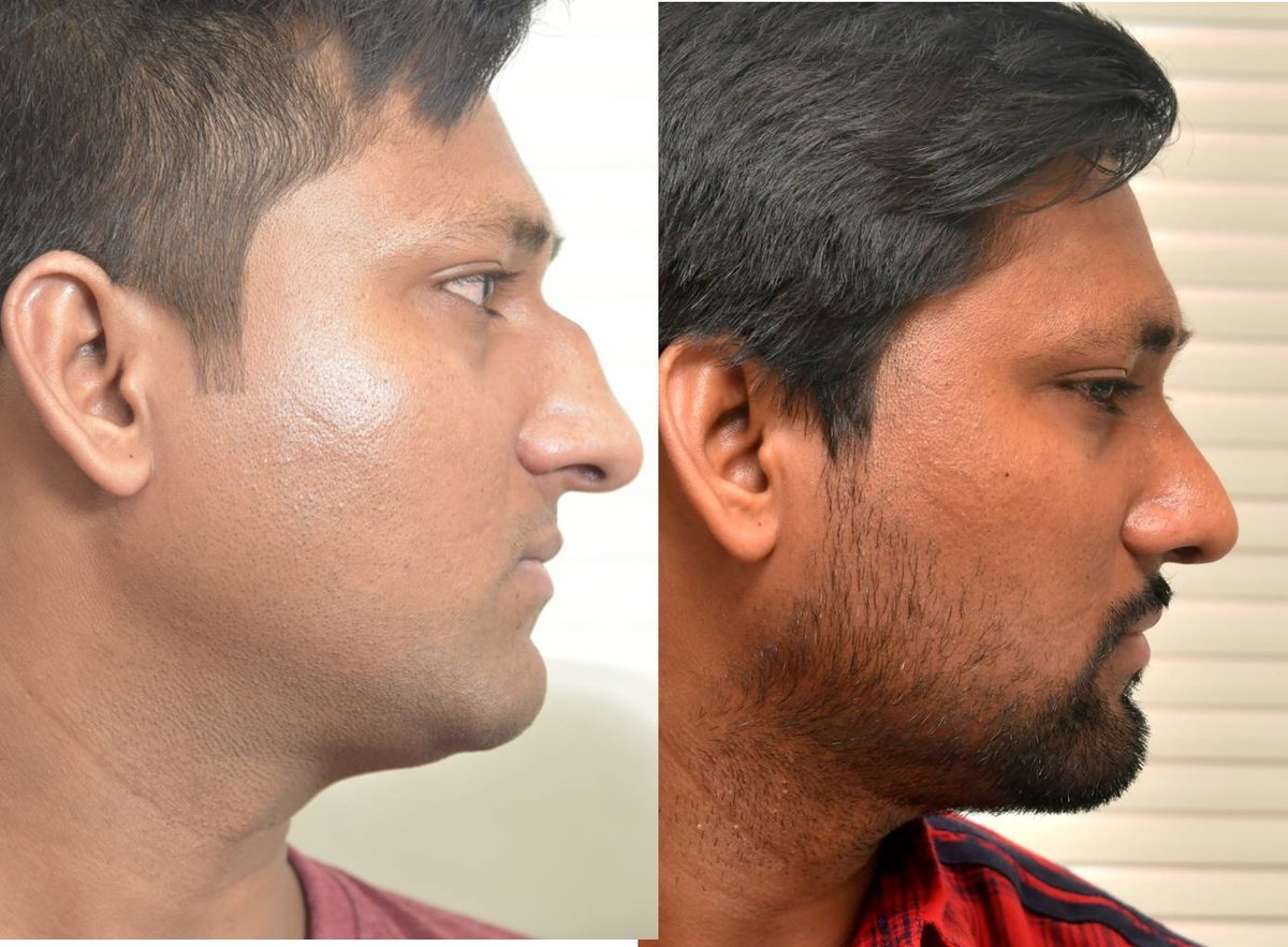 The Nose Clinic - The Nose Clinic