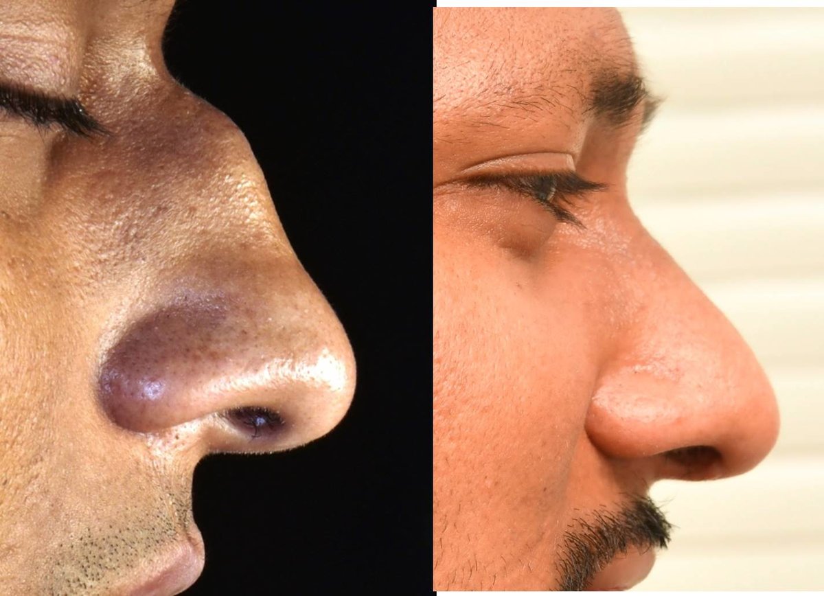 The Nose Clinic - The Nose Clinic