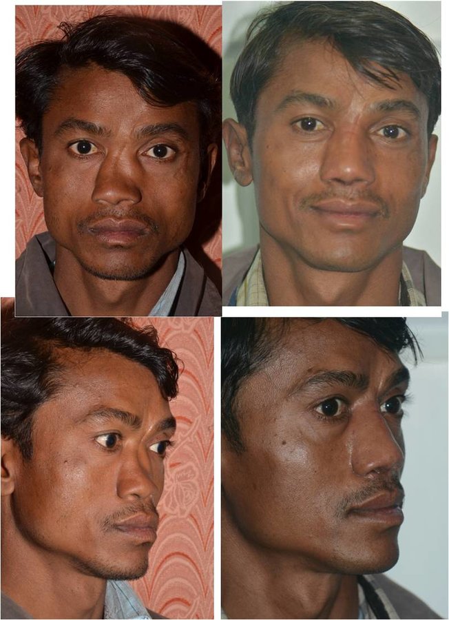 The Nose Clinic - The Nose Clinic