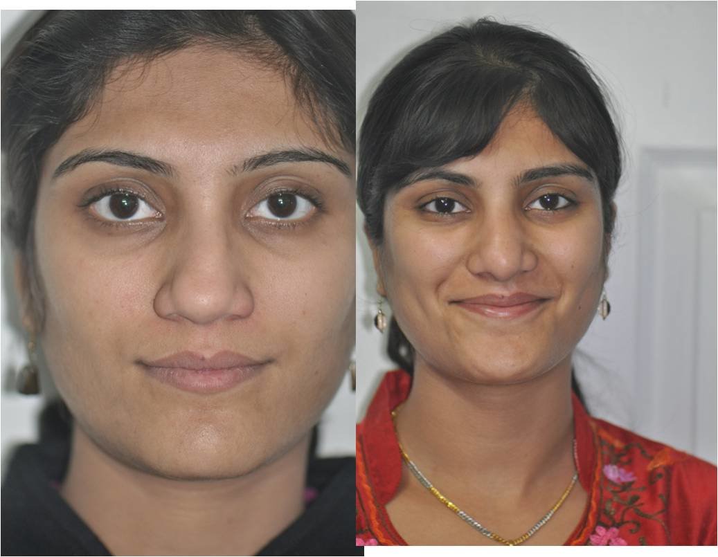 The Nose Clinic - The Nose Clinic