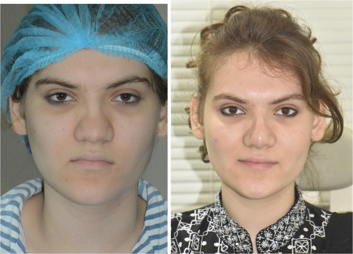 The Nose Clinic - The Nose Clinic