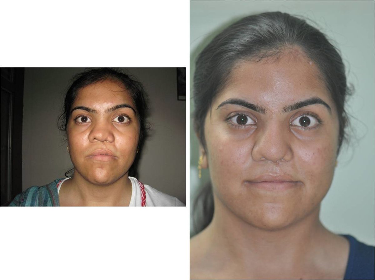 The Nose Clinic - The Nose Clinic