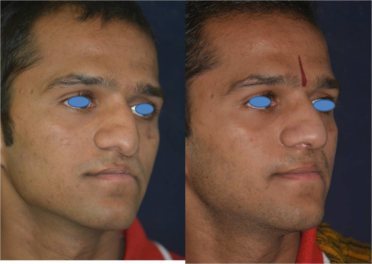 The Nose Clinic - The Nose Clinic