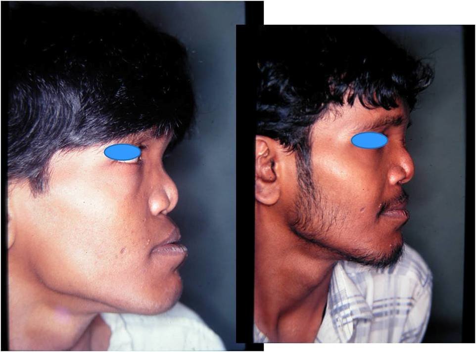 The Nose Clinic - The Nose Clinic