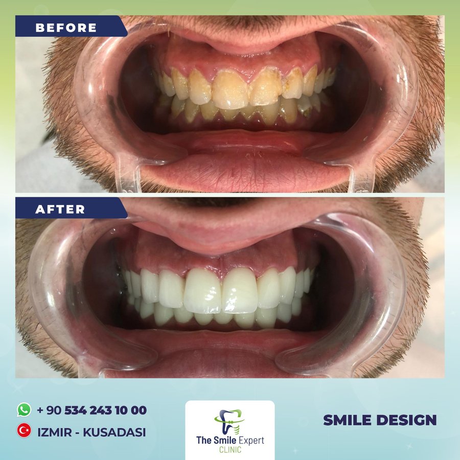 The Smile Expert Clinic - The Smile Expert Clinic