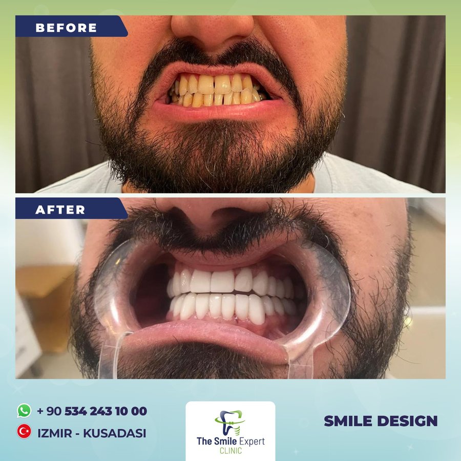 The Smile Expert Clinic - The Smile Expert Clinic