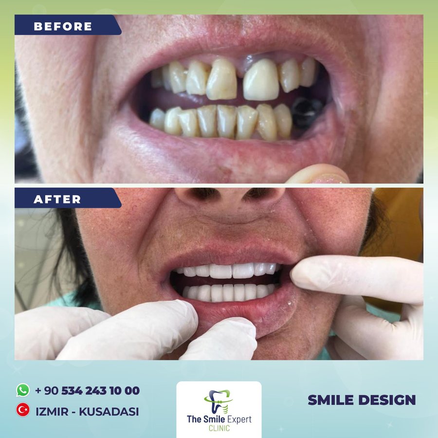 The Smile Expert Clinic - The Smile Expert Clinic