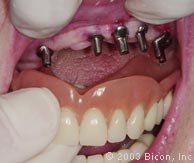 The specialty dental clinic for oral surgery & dental implant - The specialty dental clinic for oral surgery & dental implant