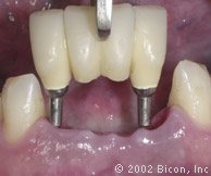 The specialty dental clinic for oral surgery & dental implant - The specialty dental clinic for oral surgery & dental implant