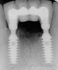 The specialty dental clinic for oral surgery & dental implant - The specialty dental clinic for oral surgery & dental implant