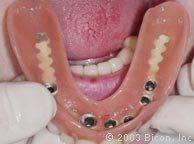 The specialty dental clinic for oral surgery & dental implant - The specialty dental clinic for oral surgery & dental implant