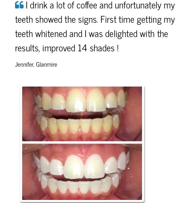 The Teeth Whitening Clinic Cork - The Teeth Whitening Clinic Cork