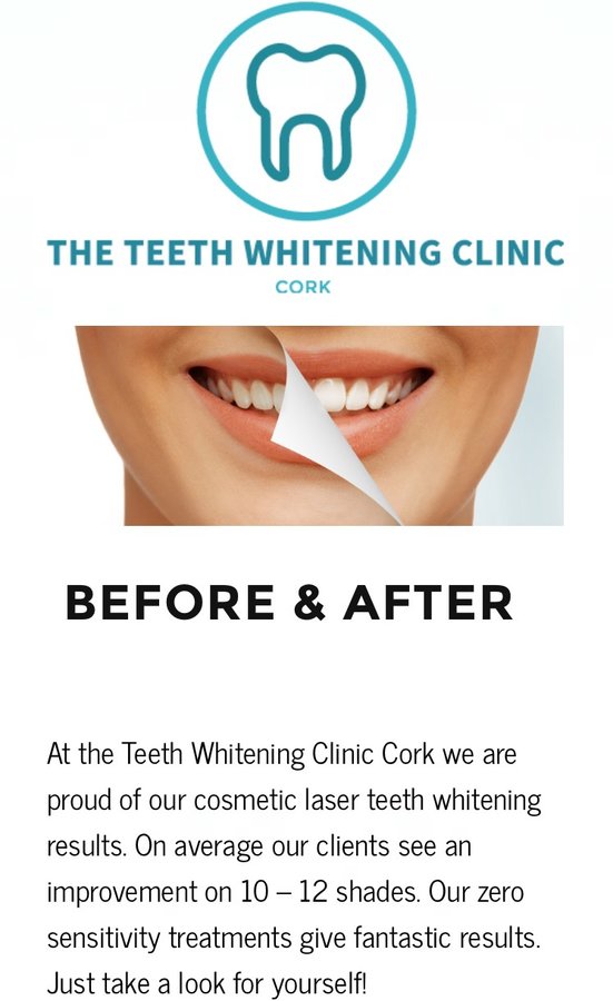 The Teeth Whitening Clinic Cork - The Teeth Whitening Clinic Cork