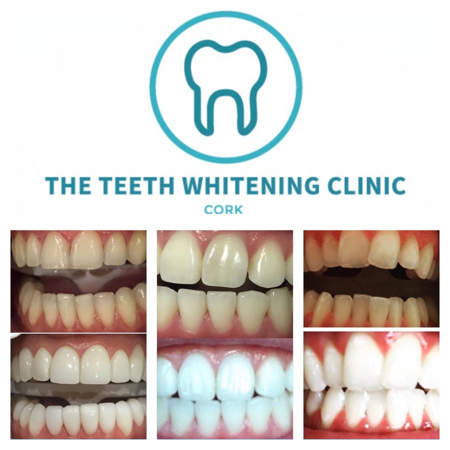 The Teeth Whitening Clinic Cork - The Teeth Whitening Clinic Cork