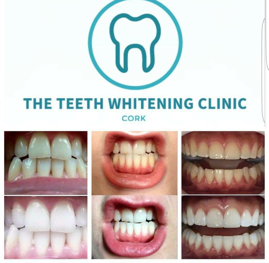 The Teeth Whitening Clinic Cork - The Teeth Whitening Clinic Cork