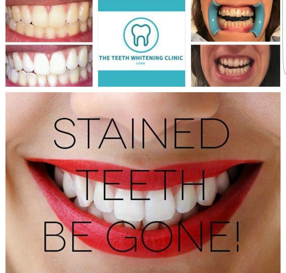 The Teeth Whitening Clinic Cork - The Teeth Whitening Clinic Cork