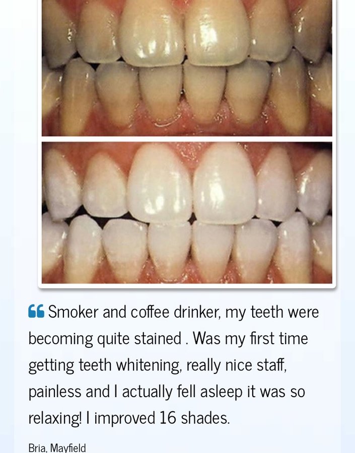 The Teeth Whitening Clinic Cork - The Teeth Whitening Clinic Cork