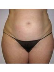 The Wellington Hospital - Platinum Medical Centre - The Wellington Hospital - Platinum Medical Centre