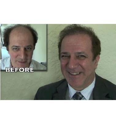 The Woods Technique - The Woods Technique