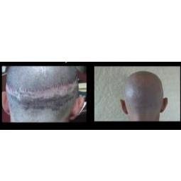 The Woods Technique - The Woods Technique