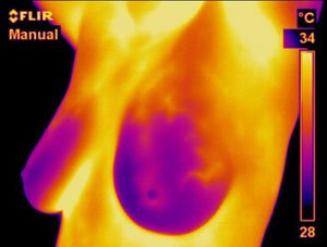 ثيرموميد - ThermoMed