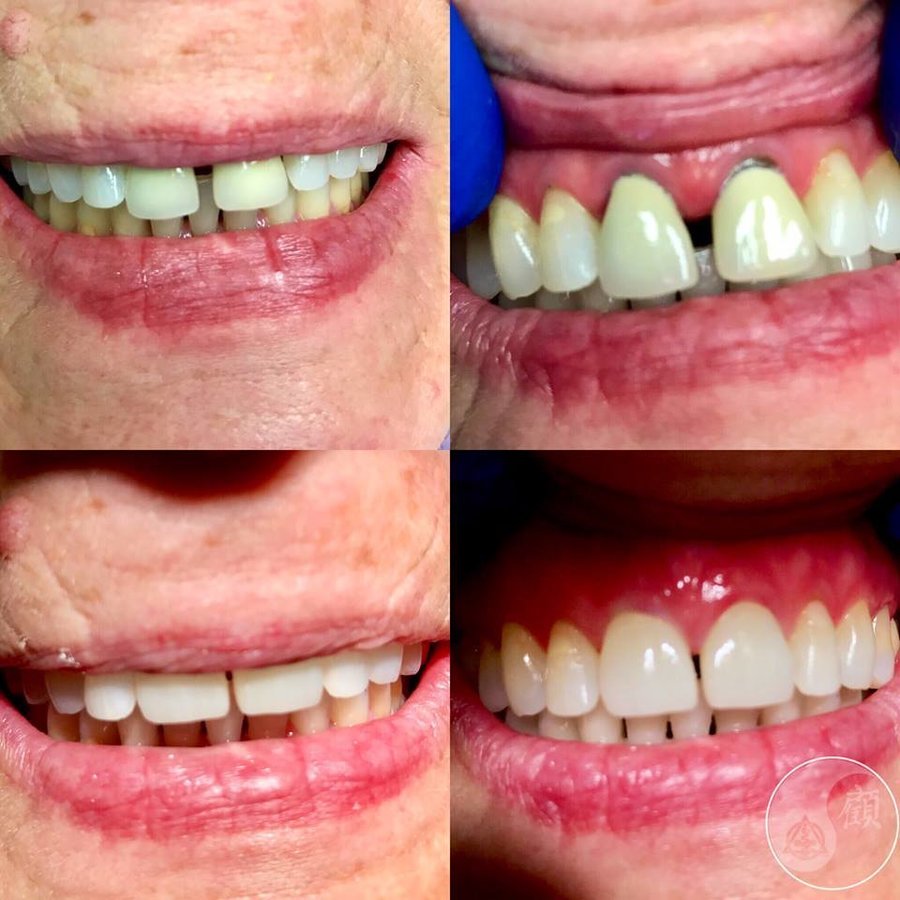 THESSALONIKI ODONTIATROI - THESSALONIKI ODONTIATROI