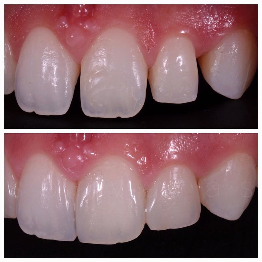 THESSALONIKI ODONTIATROI - THESSALONIKI ODONTIATROI