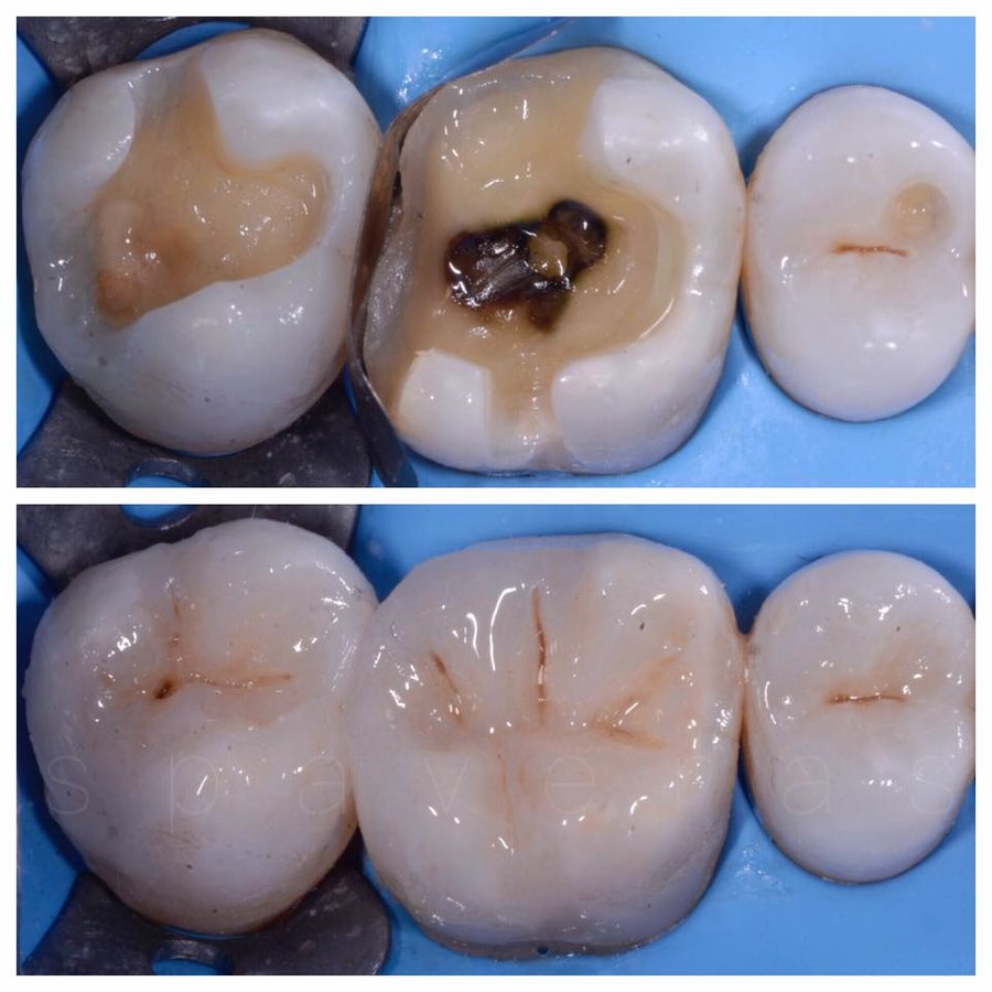 THESSALONIKI ODONTIATROI - THESSALONIKI ODONTIATROI