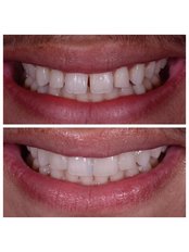 THESSALONIKI ODONTIATROI - THESSALONIKI ODONTIATROI