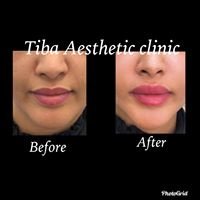Tiba Aesthetic Clinic - Tiba Aesthetic Clinic
