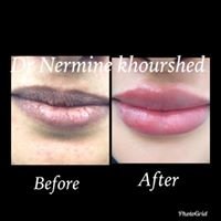 Tiba Aesthetic Clinic - Tiba Aesthetic Clinic