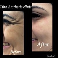 Tiba Aesthetic Clinic - Tiba Aesthetic Clinic