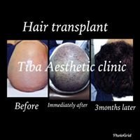 Tiba Aesthetic Clinic - Tiba Aesthetic Clinic
