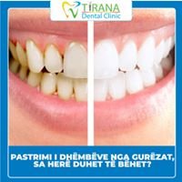 Tirana Dental Clinic - Tirana Dental Clinic
