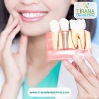 Tirana Dental Clinic - Tirana Dental Clinic