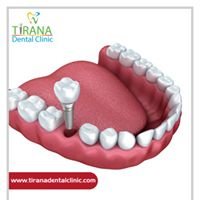Tirana Dental Clinic - Tirana Dental Clinic