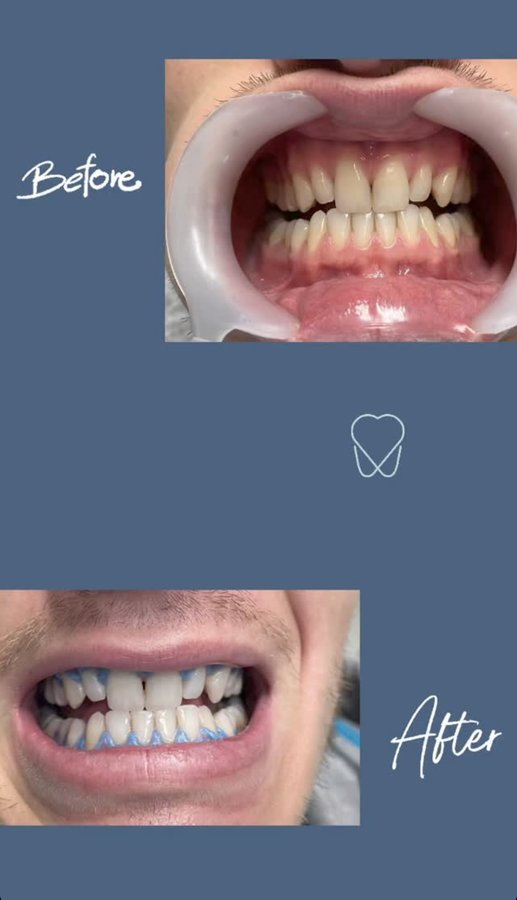 تونا لطب الأسنان - Tona Dental